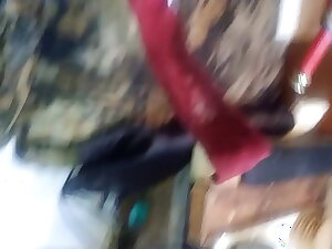 Extreme anal stretching